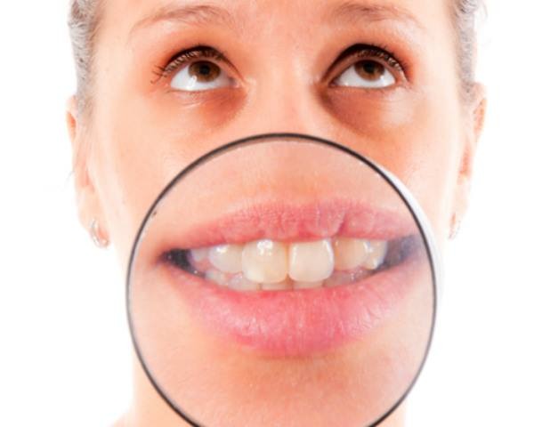 The 10 Foods That Are Harmful For Your Teeth