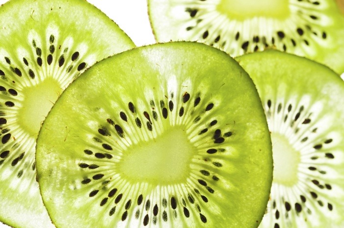 Kiwis