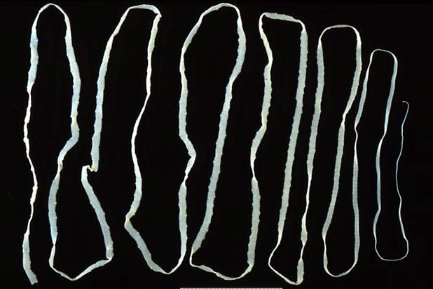Parasitic Worm Diet, Hong Kong