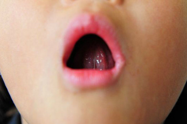 Press Your Tongue Against the Roof of the Mouth to Warm the Area