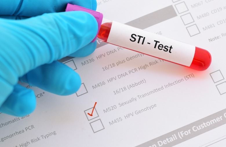 All STIs are permanent and a really big deal