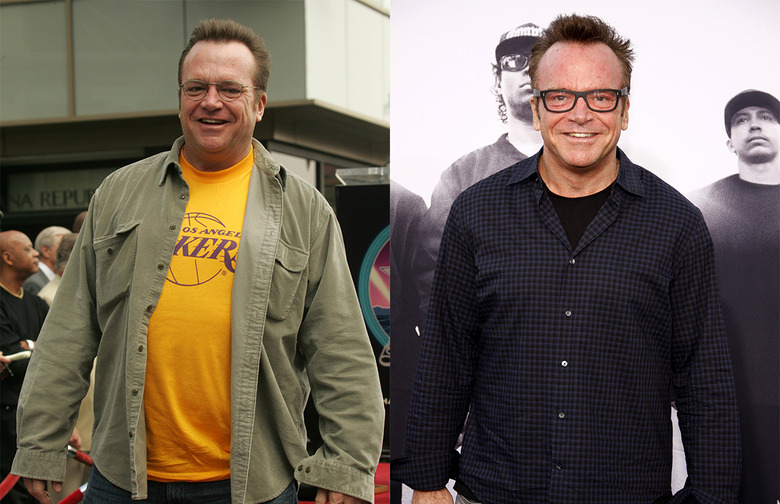 Tom Arnold