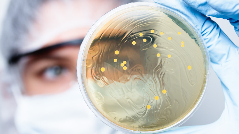 Scientist holding Lactobacillus colony