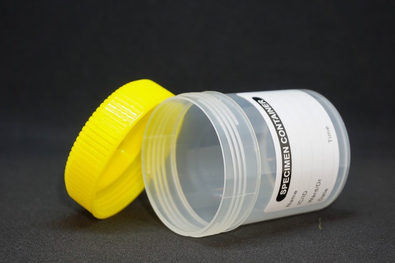 This New Urine Test Can Tell You How Healthy Your Diet Is