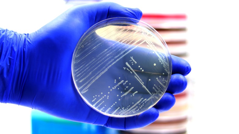 Culturing listeria in petri dish